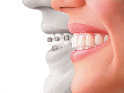 The image features a split-screen comparison of two individuals, with one side showing a person s face and the other displaying an artificial representation, possibly for dental or cosmetic purposes.