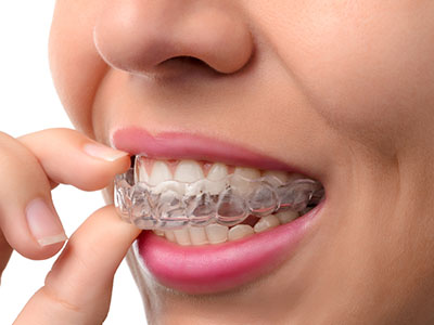 The image shows a person holding a transparent dental retainer in their hand, with a focus on the device and its transparency.