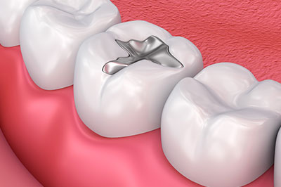 The image displays a close-up of a dental implant integrated into a tooth with surrounding gum tissue, set against a pink background that resembles the inside of a mouth.