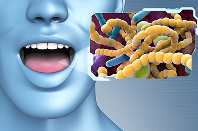 The image features a 3D rendering of a human head with an open mouth, displaying a close-up of bacteria. Below the illustration is a photograph of actual bacteria on a microscopic level, suggesting a theme of oral health or bacterial infection.