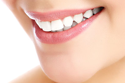 Image of a woman with a radiant smile, showcasing her teeth and lips, likely for dental or cosmetic purposes.