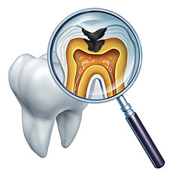 An illustration of a magnified human tooth in an oral examination context, with a focus on the pulp chamber and roots, accompanied by a dental mirror.