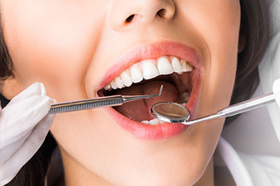 A woman with a wide smile is receiving dental treatment, with a dentist s hand visible holding a drill near her teeth.