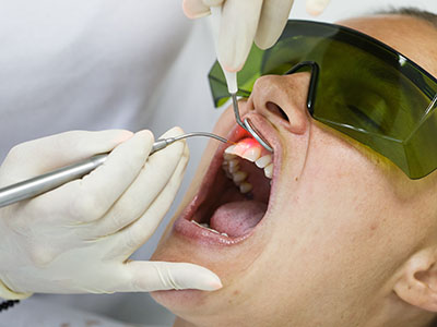 A person undergoing dental treatment, with a dentist performing the procedure.