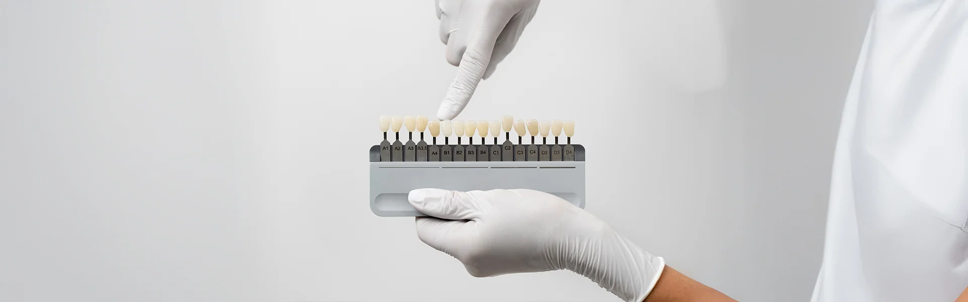 What Precautions Should You Take After Getting Veneers?